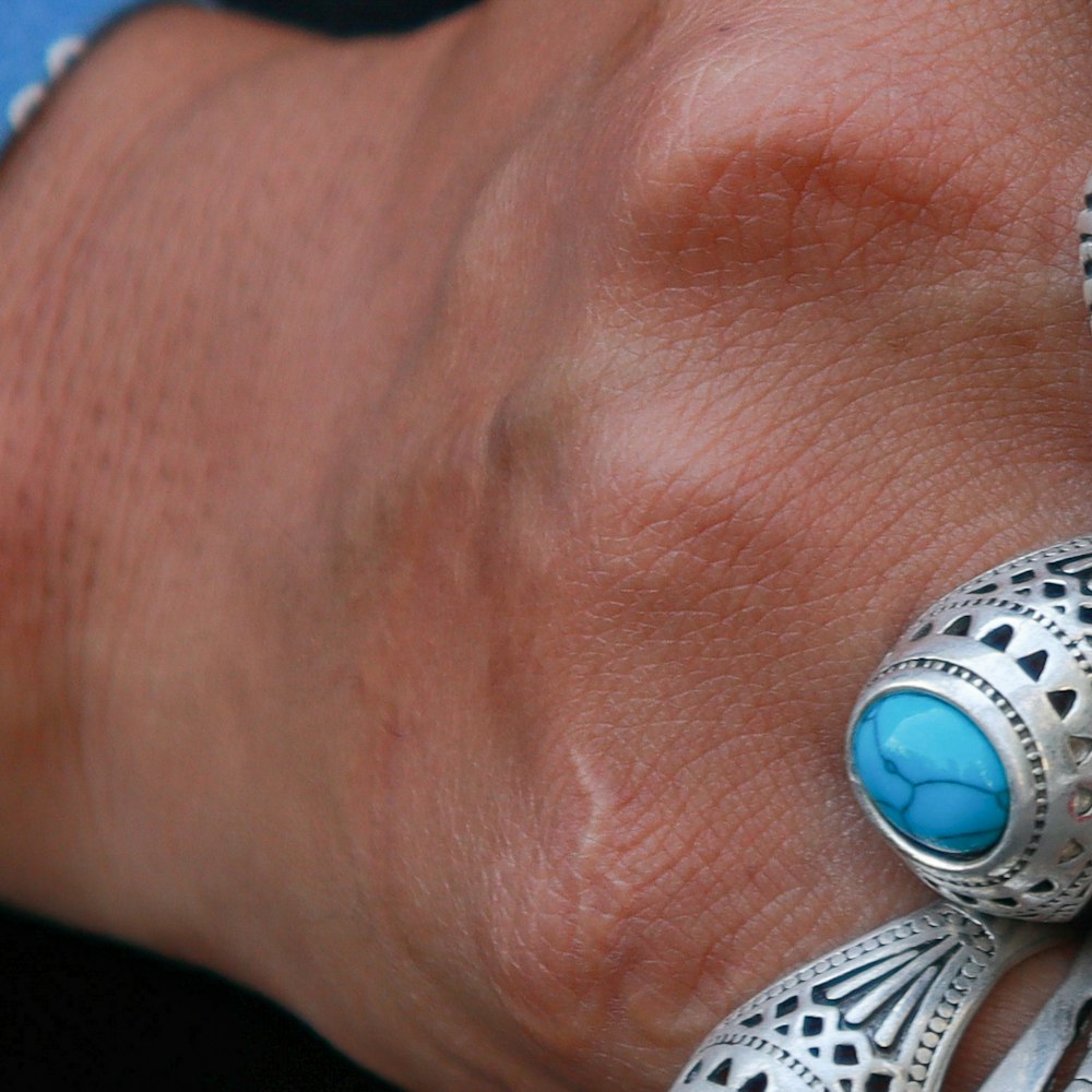 Bagues cabochons, photo 3